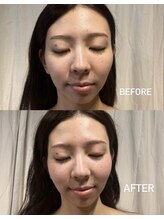 ヨサパーク インディゴ 都立大学(YOSA PARK Indigo)/デトックスコース×水素吸入