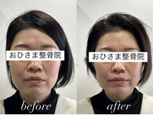 おひさま整骨院 整体院 姫路店/B＆A【姫路/小顔矯正/整体】