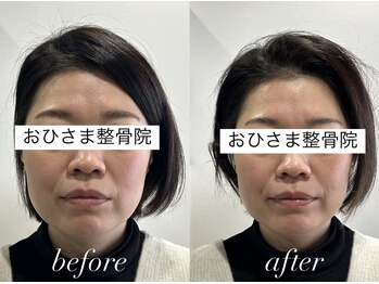 おひさま整骨院 整体院 姫路店/B＆A【姫路/小顔矯正/整体】