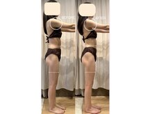 ヨサパーク インディゴ 都立大学(YOSA PARK Indigo)/デトックスコース×水素吸入