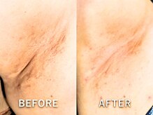 ドアディ(Doordie)/ローマピンク