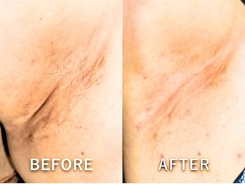 ドアディ(Doordie)/ローマピンク