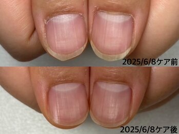 エヌ(N)/ネイリストMami限定