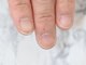 ルシェルアイの写真/【深爪/ちび爪でお悩みの方】3ヶ月で地爪を縦長に育てる最強ケアリスト在籍!3ヶ月後には自信の持てる指先へ