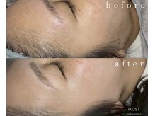 イクスト 吉祥寺(IKUST)の雰囲気（フェイシャルワックスでお肌の土台作り！マリムーブ認定サロン）