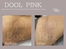 クリアボックス(Clear box)/【DOOL PINK】1月よりメニュー化