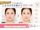 オリエンタルローザ 表参道(Oriental Rosa)の写真/ほうれい線&たるみ改善はマイクロ波リフト≪マイクロ波NEO WAVES blanche≫実感できる納得の引き締め小顔◎