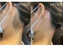 アロー(Allo!)/その日スッキリ綺麗に♪