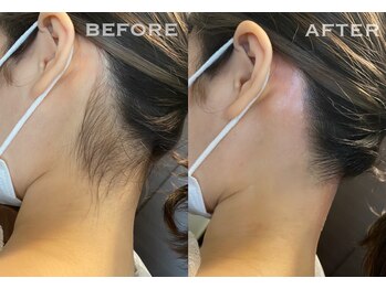 アロー(Allo!)/その日スッキリ綺麗に♪