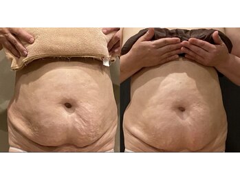 エス シークレット 金町店(S secret)/諦めなかった人には結果が出る！