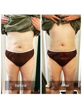 シンシア(sincere)/お腹ケア☆お腹の浮き輪スッキリ