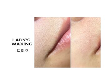ビューティーバーコア(Beauty bar KOA)/ワックス脱毛（口周り）