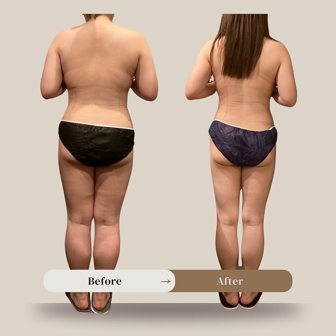 琥珀 アザブ(AZABU)｜ホットペッパービューティー