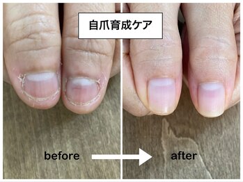 コバコ(kobaco)/弄り癖改善　8ヶ月の成果比較