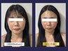 別人級に★極【頭蓋骨小顔矯正＋たるみ改善美容液】老化悩み改善網羅！120分