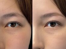 ユニ(uni)/Before / After