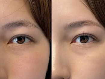 ユニ(uni)/Before / After