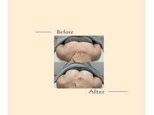 オベリオ(OBERIO)/