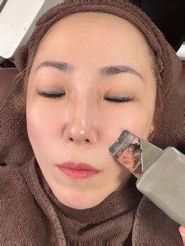 エンジェル(Angel)/毛穴洗浄