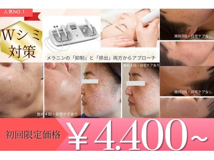 ハートエルボー(Heart elbow)の写真