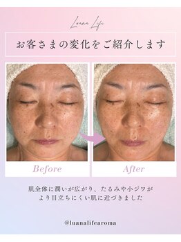ルアナライフ(Luana Life)/乾燥たるみ、美白ケアに