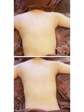 ロージーハピネス(Rosy happiness)/筋膜をほぐす