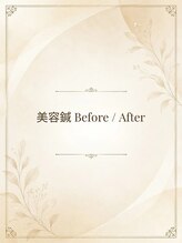 長寿鍼灸院 長寿整骨院/美容鍼の変化を実感。