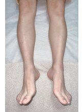 エムズリボーン 那覇店(M's ReBorn)/Mパーツ(各部位)¥3500~