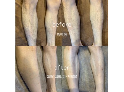 アレーズ(ALAISE)の写真