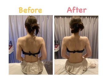 クレビア 麻布十番(CREBIA)/【痩身/代謝促進】