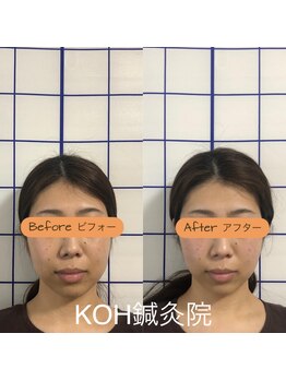 コウ鍼灸院(KOH鍼灸院)/