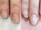 ネイルケア/ハンドケアで若見え