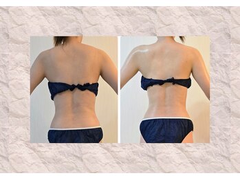 プライベートエステティックサロン アメジスト(AMETHYST)/痩身メニューも充実