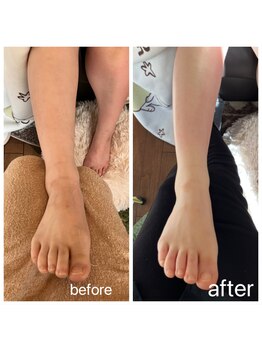 セルラム札幌 アンド 足つぼサロンリン(Rin)/足が変わると身体も変わる！