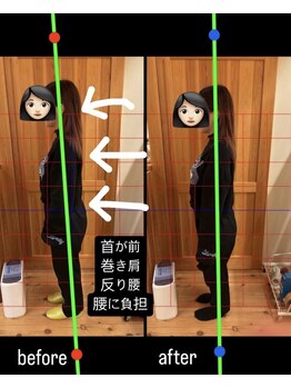 はまもと整骨院/整体・姿勢改善