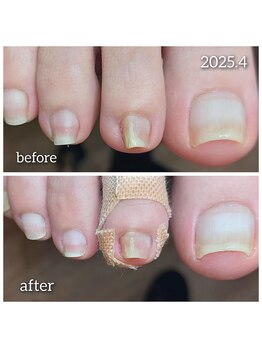 爪切り屋 足楽/