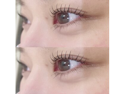 シヨン(Ciyon.)の写真