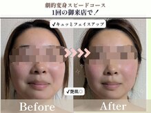 ヨサパーク アエル(YOSA PARK AELL)/１回で！よもぎ蒸し/小顔/むくみ