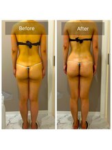 オーバイワン 横浜店/お客様Before＆After【2】