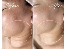 ルポ 鶴見(Repos)