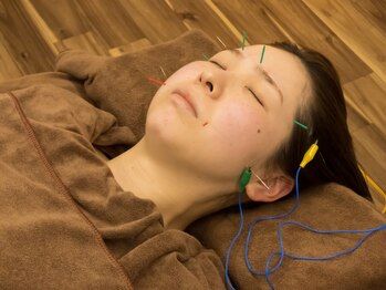 ラディアント 吉祥寺/鍼×ヘッドスパ