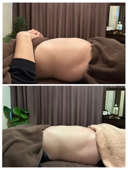 ザソースオブビューティ(The Source of Beauty)の写真/お腹の厚みが気になる方や痩せにくい方はもちろん、便秘、腰痛、太ももの張りなどにもお試しください!