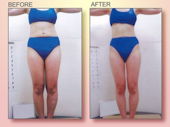 ジュリア オージェ 京橋店/ビフォーアフター(美脚)