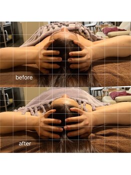 サン(SAN)/脳洗浄B/A