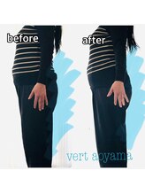 ヴェール 青山(vert)/骨盤矯正ビフォーアフター