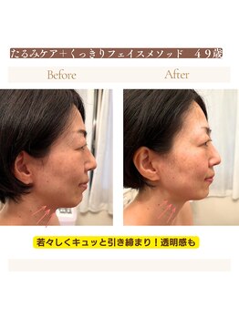 ルルドフォンテ(rurudo fonte.)/フェイスラインのもたつき解消!