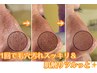 〈毛穴洗浄×贅沢美容液〉【角栓/肌荒れ/毛穴】★¥6,600→¥4,900