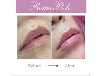 ルアナ 柏店(LUANA)/ローマピンク