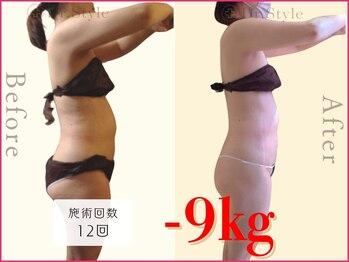 ココア 春日井店(cocoa)/整体&産後骨盤矯正&痩身/春日井