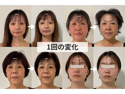 こつこつラボ サンイチマル オオル(310/OOL')の写真